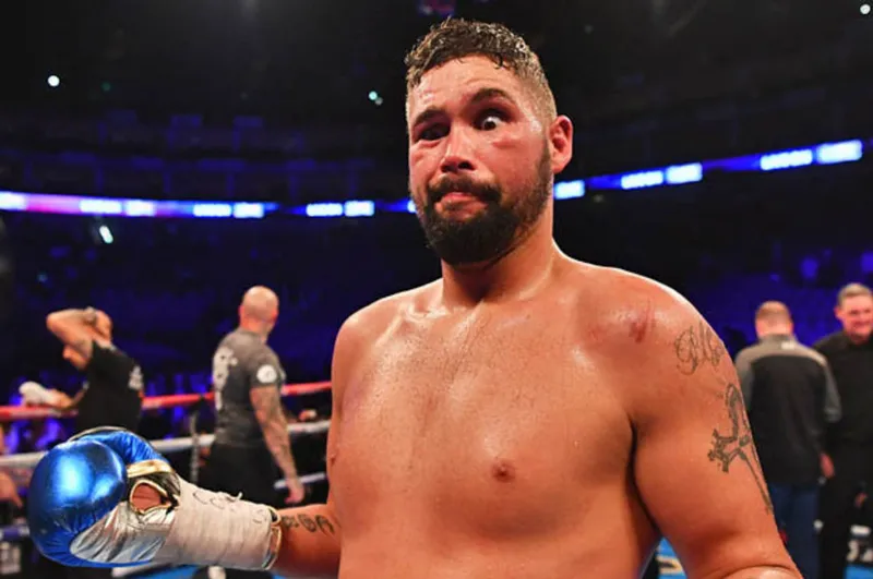 Tony Bellew: 